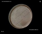 Haemophilus influenzae virulent strain